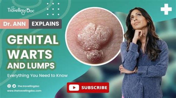 Did your genital warts come back?