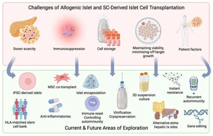 Is it allogeneic or allogenic?