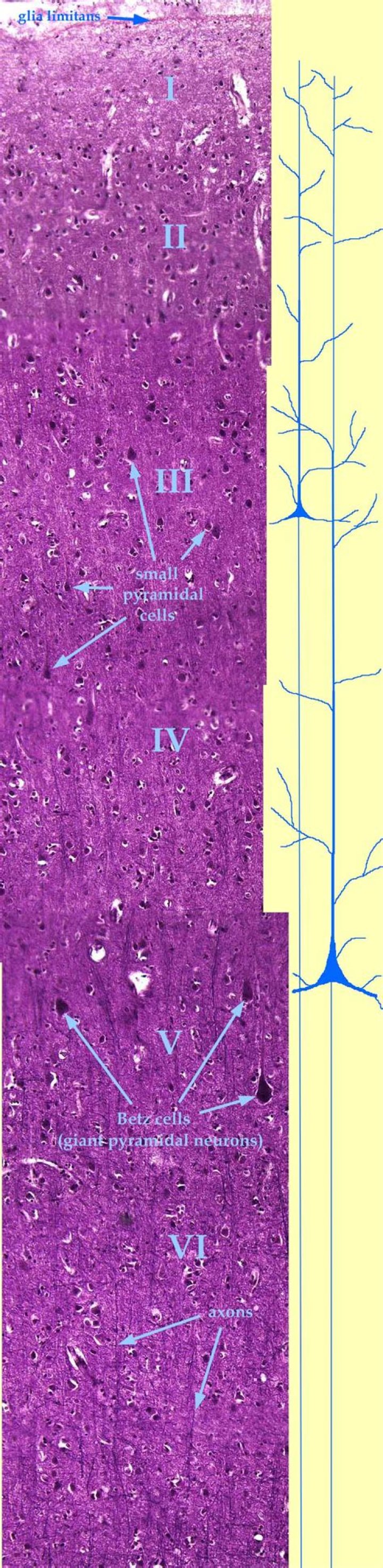 What does acervuli meaning?