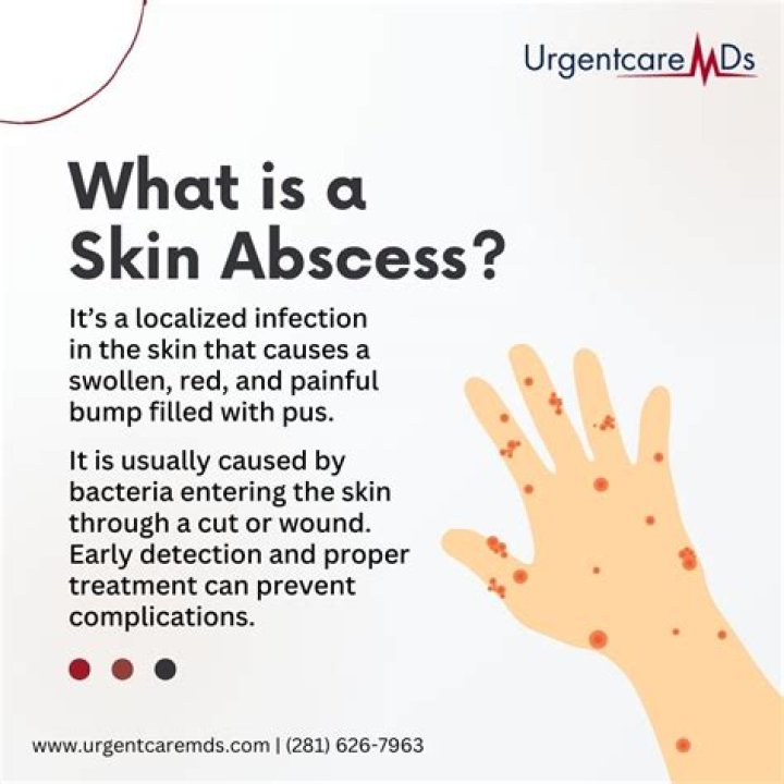 Why are abscesses so painful?