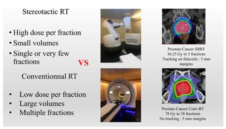 Why radiosurgery is done?